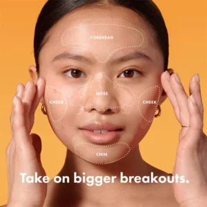 Alternative view of ELAIMEI™ Mighty Face Invisible Acne Patch