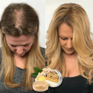 Alternative view of GingerPro Hair Regrowth Shampoo Bar