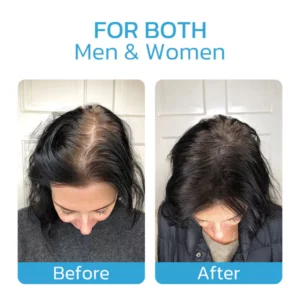 Alternative view of Hairmuch Hair Regrowth Ampoule Serum