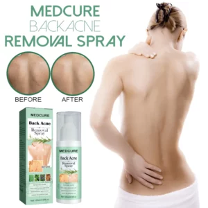 Alternative view of MEDCure BackAcne Removal Spray