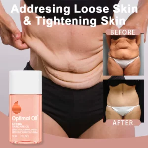 Alternative view of Optimal Oil®Collagen Boost Firming & Lifting Skincare Oil