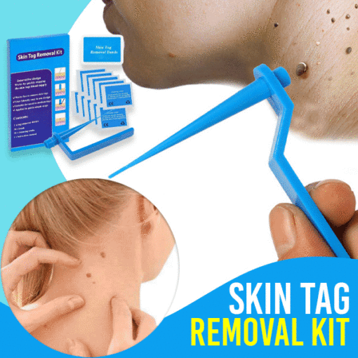 Skin Tag Remover Kit