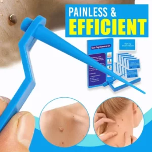 Alternative view of Skin Tag Remover Kit