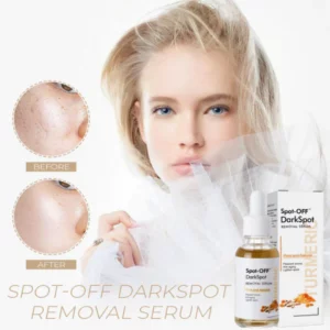 Alternative view of Spot-OFF™ DarkSpot Removal Serum