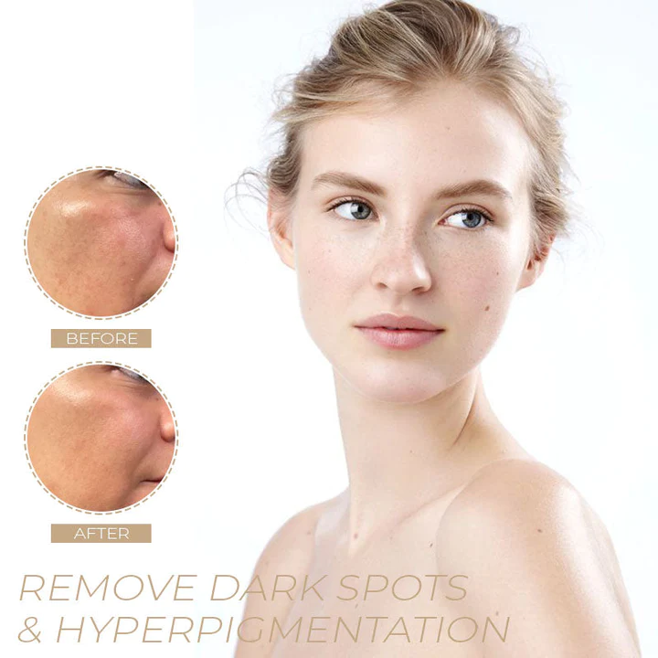 Spot-OFF™ DarkSpot Removal Serum - Image 4