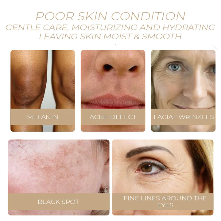 Spot-OFF™ DarkSpot Removal Serum - Image 5