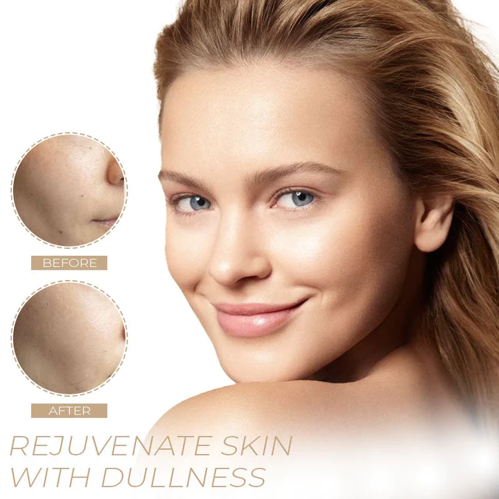 Spot-OFF™ DarkSpot Removal Serum - Image 6