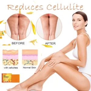 Alternative view of VitaminC CelluBurn Tightening Soap