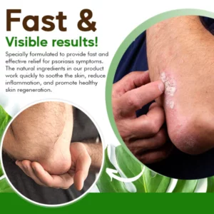 AEXZR™ Psoriasis Cure Essential Oil