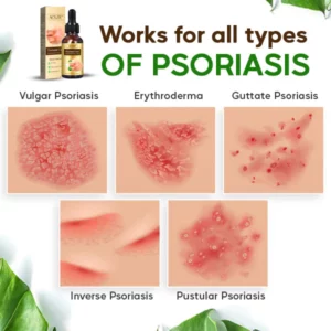 AEXZR™ Psoriasis Cure Essential Oil