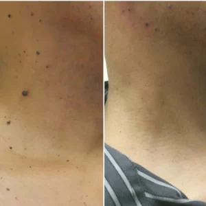 AEXZR™ Skin Spot Removal Serum