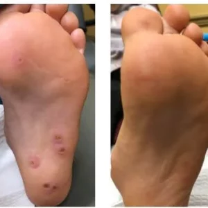 AEXZR™ Skin Spot Removal Serum