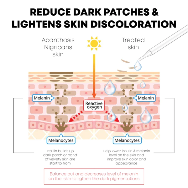 ATTDX AcanthosisNigricans Treatment Oil - Image 4