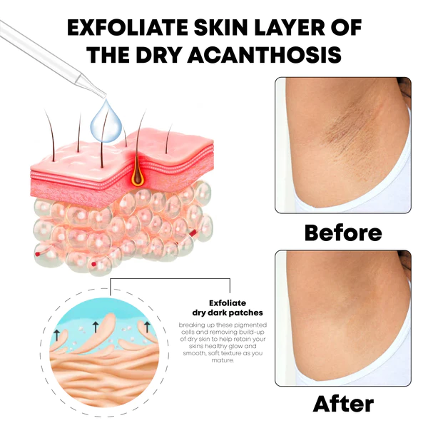 ATTDX AcanthosisNigricans Treatment Oil - Image 6