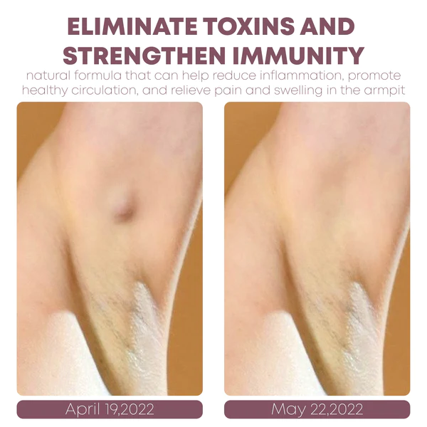 ATTDX LymphCare DetoxificationHerbal Patch - Image 6