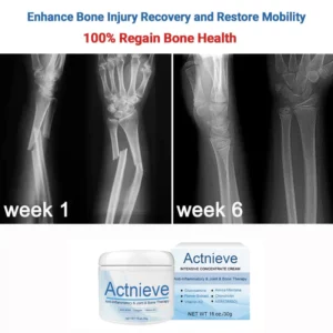 Alternative view of Actnieve™ Anti-Inflammatory & Joint & Bone Therapy Cream
