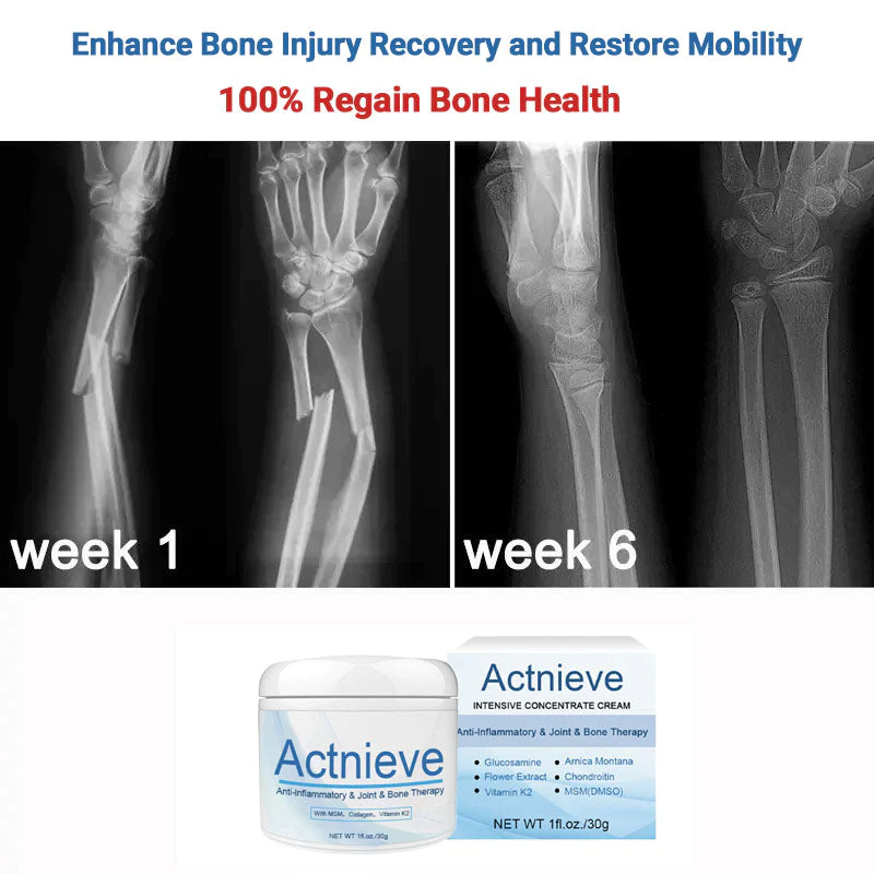 Actnieve™ Anti-Inflammatory & Joint & Bone Therapy Cream - Image 2