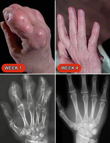 Actnieve™ Anti-Inflammatory & Joint & Bone Therapy Cream - Image 7