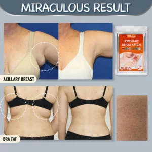 Alternative view of Armpit Fat Removal Lymphatic Pad