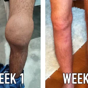 ArthriHeal™ Joint & Bone Drops