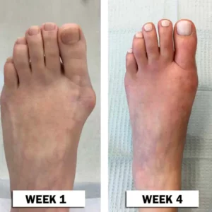 ArthriHeal™ Joint & Bone Drops