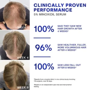 Blusoms™ HairGrowth Formula Serum Spray