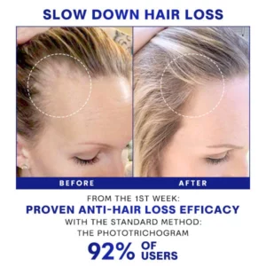 Blusoms™ HairGrowth Formula Serum Spray