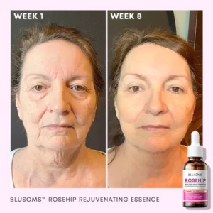 Blusoms™ Rosehip Rejuvenating Essence