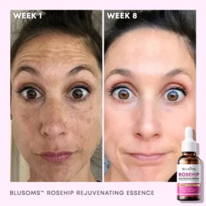 Blusoms™ Rosehip Rejuvenating Essence