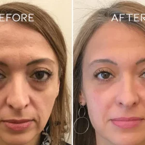 BounceBack Wrinkle Moisturizing Balm