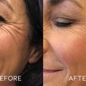 BounceBack Wrinkle Moisturizing Balm