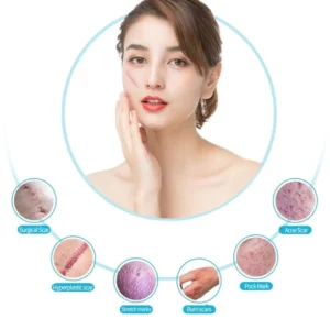Breezy™ Advanced Collagen Boost Anti Aging Serum