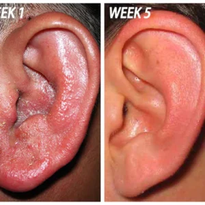ClearEar® healing and restorative ear drop