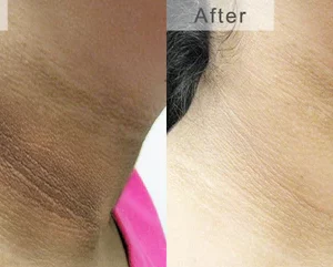 DETVFO Dark Spot Cream