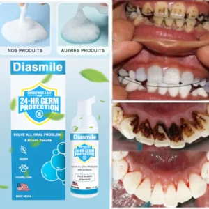 Diasimle™ Mousse Blanchissante Super Pure à base de Plantes pour la Réparation des Dents et de la Bouche