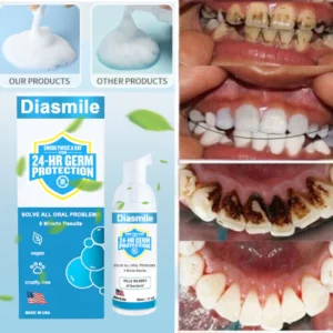 Diasmile™ Pure Herbal Super Whitening Teeth & Mouth Repair Foam