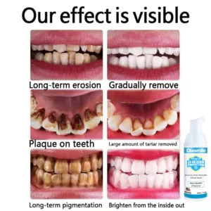 Diasmile™ Pure Herbal Super Whitening Teeth & Mouth Repair Foam
