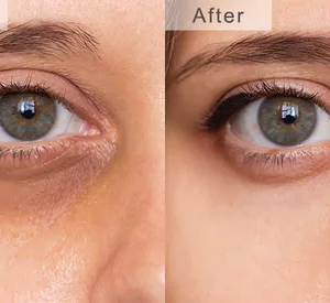 EyeJuvenate Collagen Niacinamide Eye Cream
