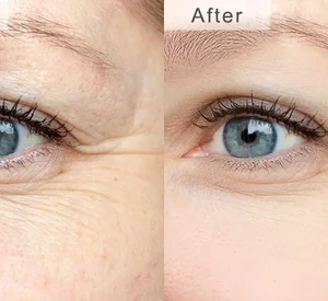 EyeJuvenate Collagen Niacinamide Eye Cream