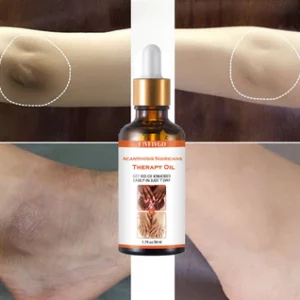 Fivfivgo™ Acanthosis Nigricans Therapy Oil