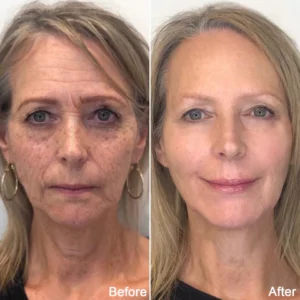 Fivfivgo™ BeautF Golden Age Ultimate Refining Anti-Aging Serum