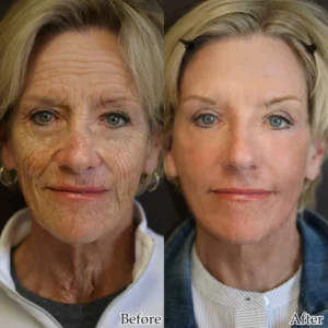 Fivfivgo™ BeautF Golden Age Ultimate Refining Anti-Aging Serum