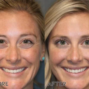 Fivfivgo™ Korean Snail Collagen Lifting & Firming Mist
