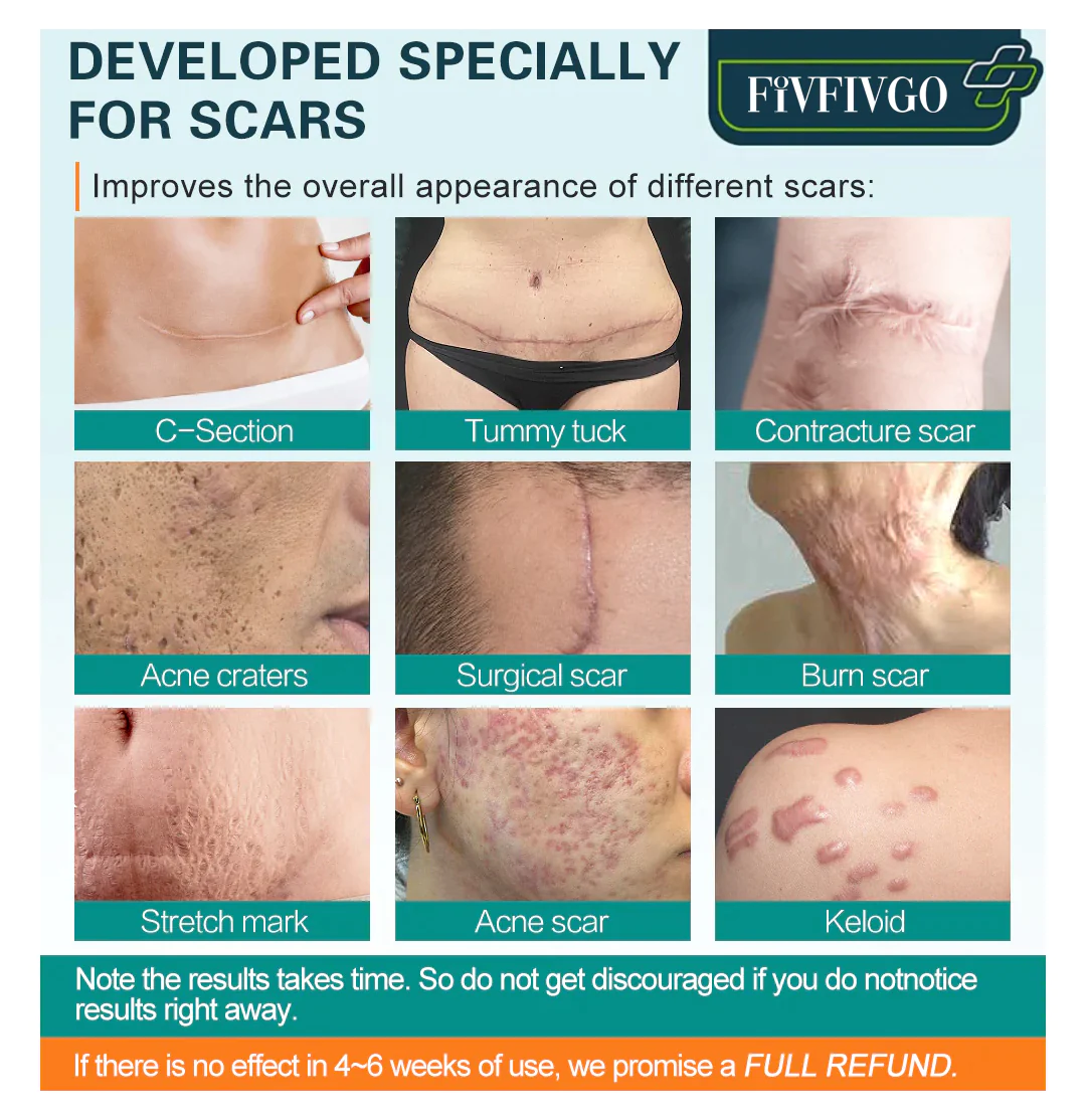 Fivfivgo™ ScarRemove Advanced Scar Spray - Image 6