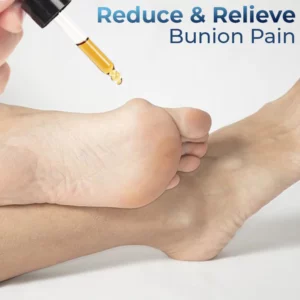 Alternative view of GFOUK™ German Bunion Relief Oil