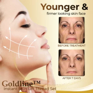 Goldline™ Instant Skin Lift Thread Set
