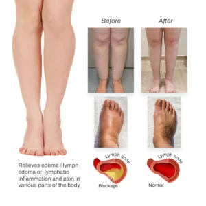 Alternative view of Herbalax Lymphvity BodyDetox FootPatch