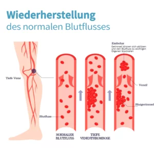 KNEECA Tourmaline Selbstheizende Kniehülse
