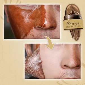 Maskiss™ Herbal Peel Off Mask
