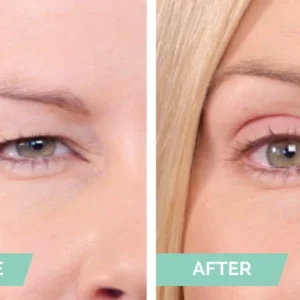 Alternative view of One® Natural Invisible Eyelid